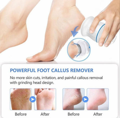 Electric Callus Remover